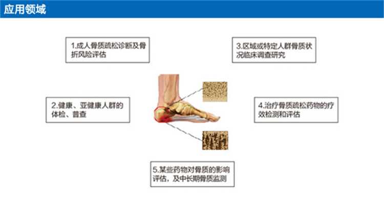 OSTEOKJ3000超声骨密度仪引用领域